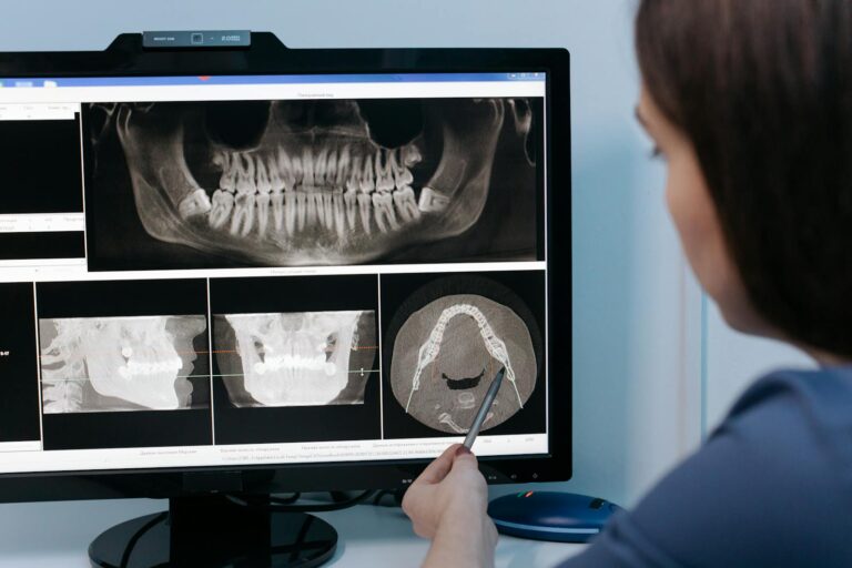 Orthodontist examining a patient’s X-ray to assess wisdom tooth position